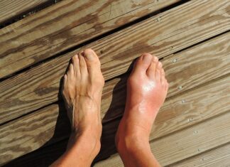 Jaka woda przy dnie moczanowej?